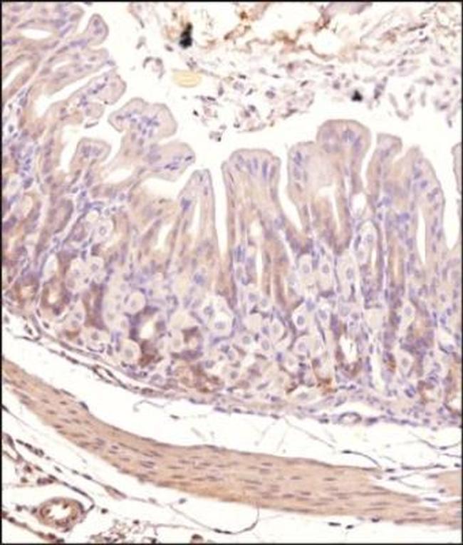 TEK Antibody in Immunohistochemistry (Paraffin) (IHC (P))