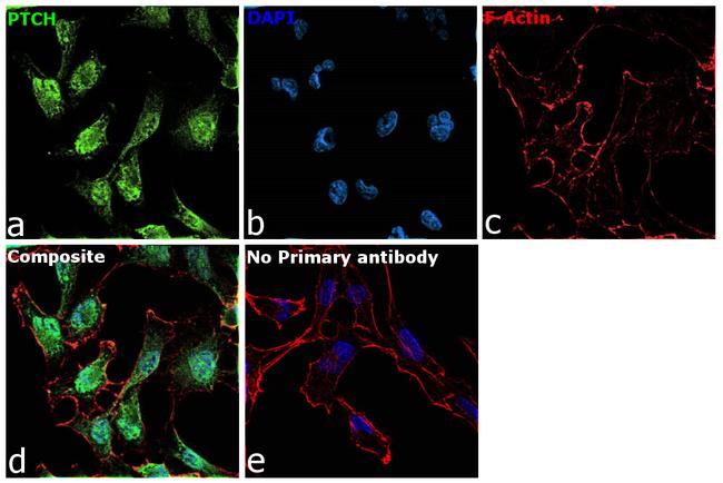 PTCH Antibody in Immunocytochemistry (ICC/IF)