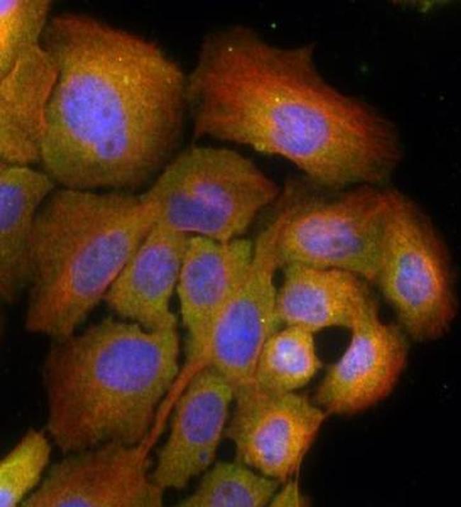 RAB7 Antibody in Immunocytochemistry (ICC/IF)