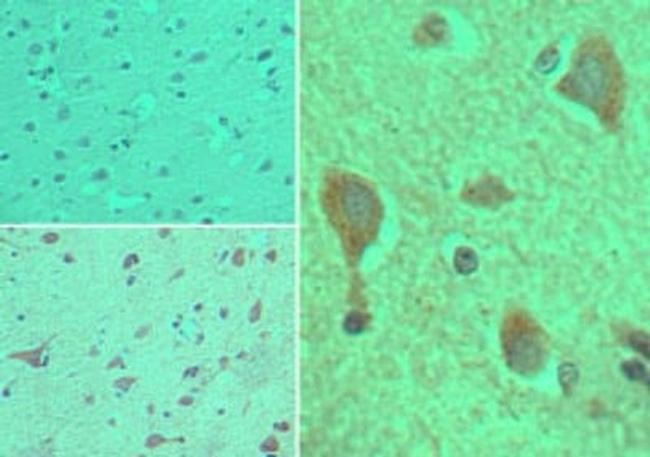 CYP1B1 Antibody in Immunohistochemistry (Paraffin) (IHC (P))