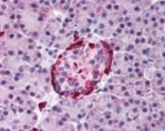 EphA2 Antibody in Immunohistochemistry (Paraffin) (IHC (P))