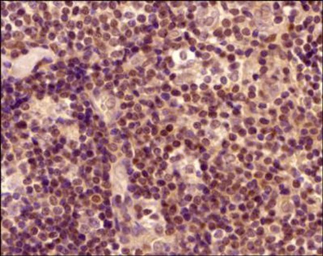 ROR gamma Antibody in Immunohistochemistry (Paraffin) (IHC (P))