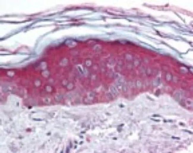 ARHGEF11 Antibody in Immunohistochemistry (Paraffin) (IHC (P))