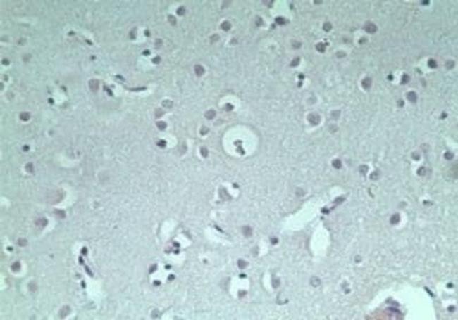 RNF128 Antibody in Immunohistochemistry (Paraffin) (IHC (P))