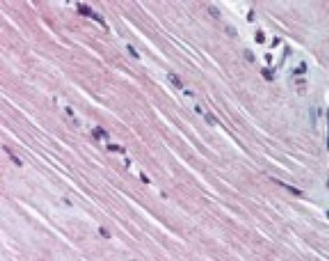 AMPD1 Antibody in Immunohistochemistry (Paraffin) (IHC (P))