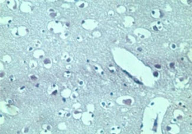 TRBP Antibody in Immunohistochemistry (Paraffin) (IHC (P))