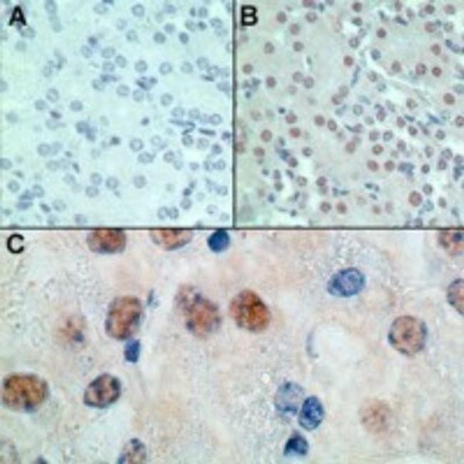 MSX1 Antibody in Immunohistochemistry (Paraffin) (IHC (P))