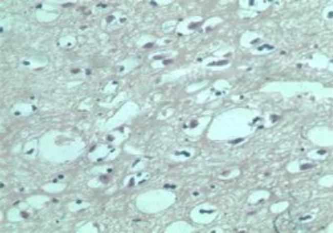 EDG8 Antibody in Immunohistochemistry (Paraffin) (IHC (P))