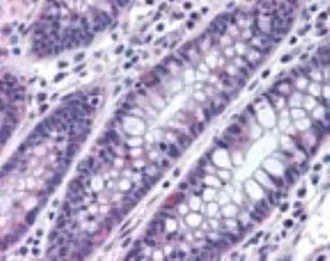 MTSS1 Antibody in Immunohistochemistry (Paraffin) (IHC (P))