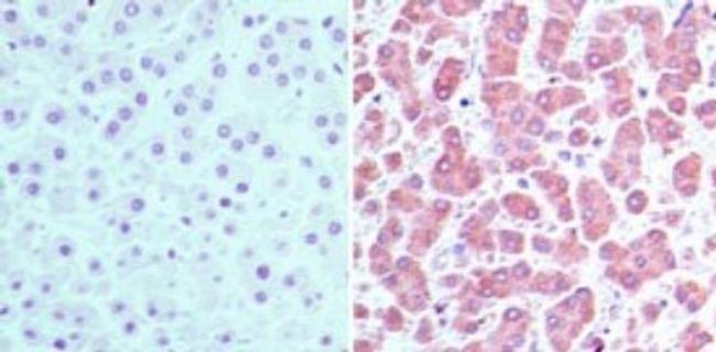 CRABP2 Antibody in Immunohistochemistry (Paraffin) (IHC (P))