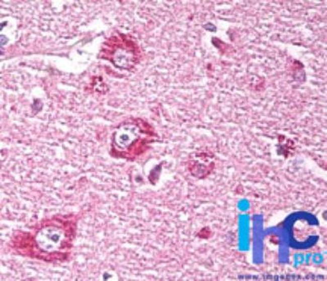 DACT1 Antibody in Immunohistochemistry (Paraffin) (IHC (P))