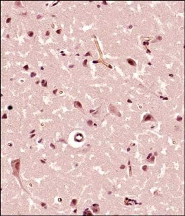 FMN2 Antibody in Immunohistochemistry (Paraffin) (IHC (P))