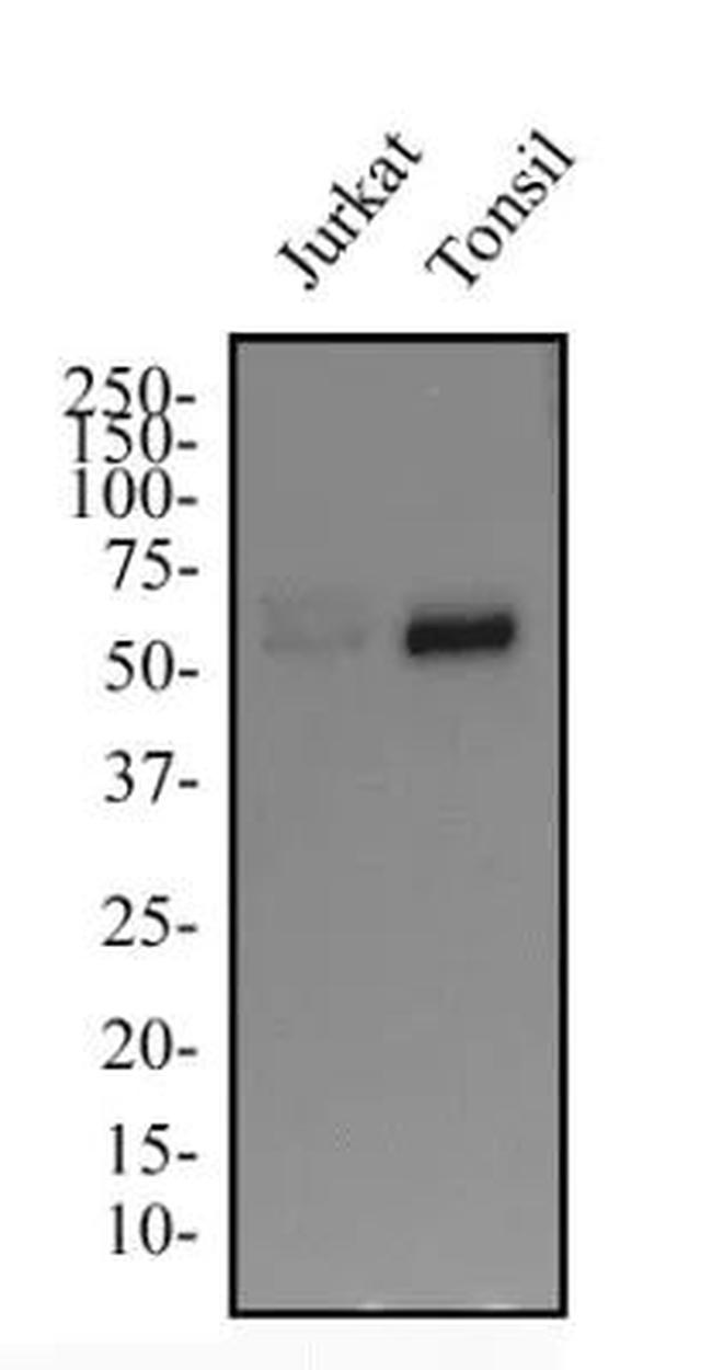 IKZF3 Antibody in Western Blot (WB)