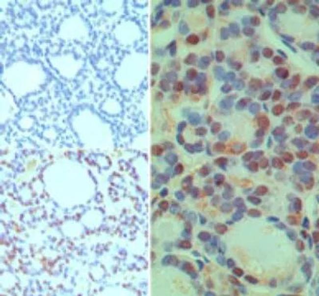 CUEDC2 Antibody in Immunohistochemistry (Paraffin) (IHC (P))