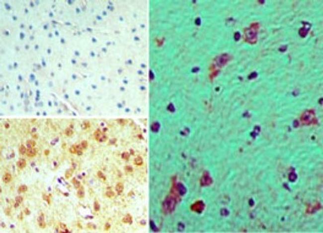 FHOD3 Antibody in Immunohistochemistry (Paraffin) (IHC (P))