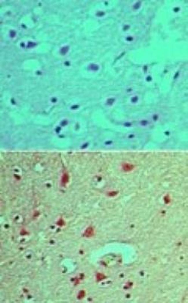 Phospho-SHIP2 (Tyr497) Antibody in Immunohistochemistry (Paraffin) (IHC (P))