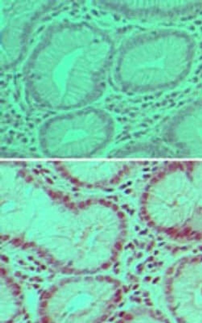 USP7 Antibody in Immunohistochemistry (Paraffin) (IHC (P))