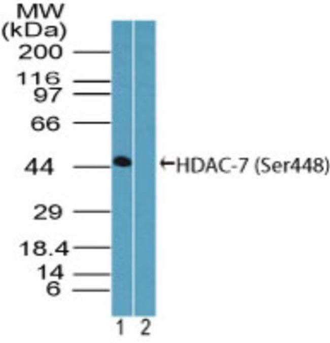 Phospho-HDAC7 (Ser448) Antibody in Western Blot (WB)