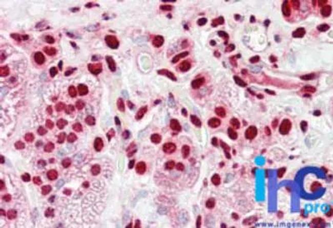 hnRNP K Antibody in Immunohistochemistry (Paraffin) (IHC (P))