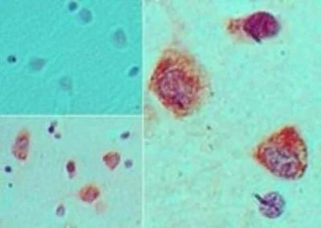 S1P1 Antibody in Immunohistochemistry (Paraffin) (IHC (P))