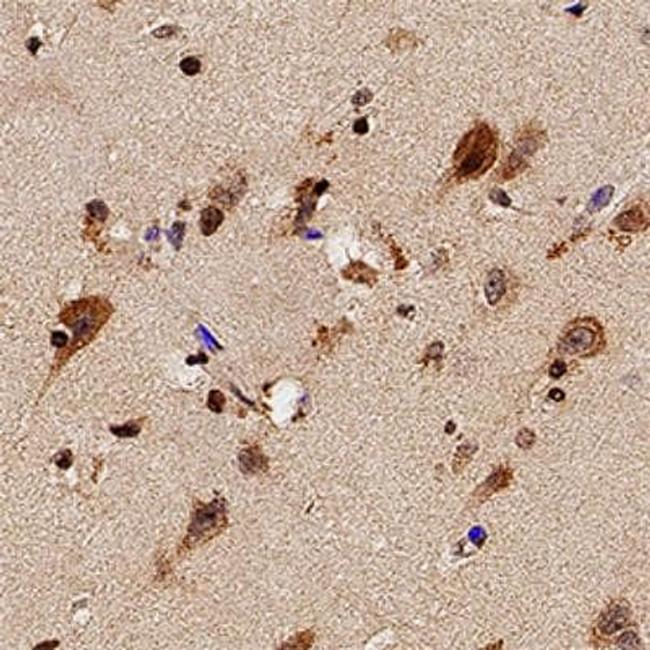 TLR7 Antibody in Immunohistochemistry (Paraffin) (IHC (P))