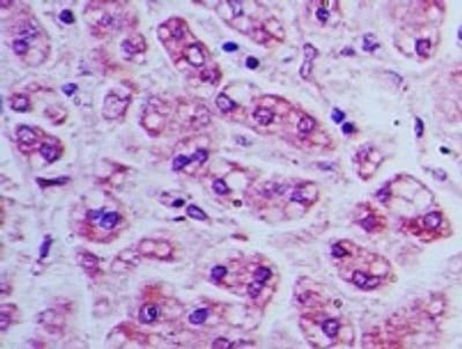 BST-2 Antibody in Immunohistochemistry (Paraffin) (IHC (P))