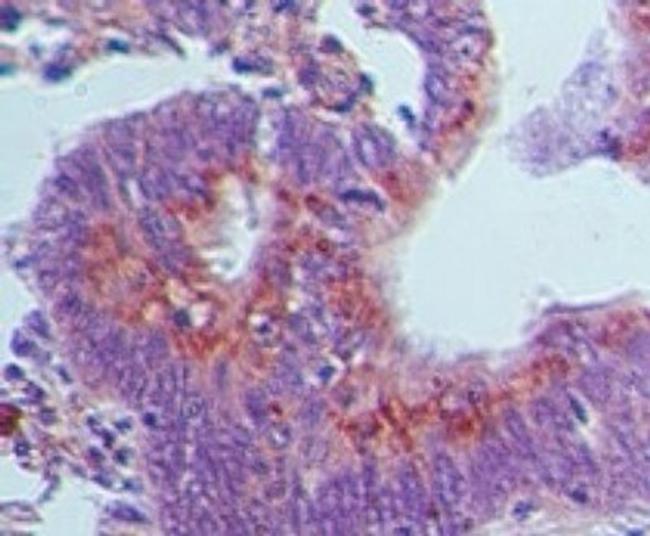 GBP1 Antibody in Immunohistochemistry (Paraffin) (IHC (P))