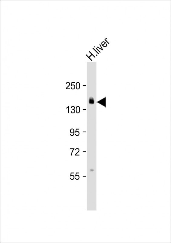 AEBP1 Antibody in Western Blot (WB)