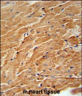 CCL21 Antibody in Immunohistochemistry (Paraffin) (IHC (P))