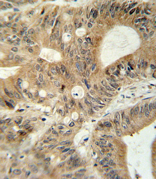 MRP3 Antibody in Immunohistochemistry (Paraffin) (IHC (P))