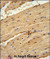 TIMP4 Antibody in Immunohistochemistry (Paraffin) (IHC (P))