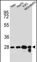 CHPT1 Antibody in Western Blot (WB)