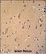 GCC2 Antibody in Immunohistochemistry (Paraffin) (IHC (P))