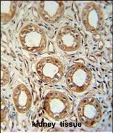 LNPEP Antibody in Immunohistochemistry (Paraffin) (IHC (P))