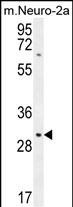 TMEM65 Antibody in Western Blot (WB)