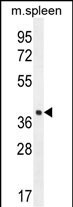 LHFPL5 Antibody in Western Blot (WB)