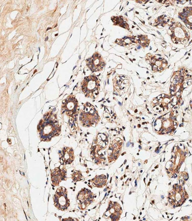 ALOXE3 Antibody in Immunohistochemistry (Paraffin) (IHC (P))