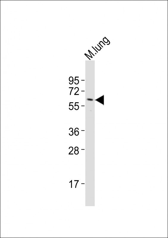 Angiopoietin 1 Antibody in Western Blot (WB)