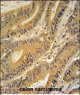 GNAT3 Antibody in Immunohistochemistry (Paraffin) (IHC (P))