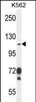 CD103 Antibody in Western Blot (WB)