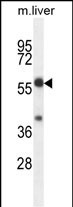 TBCCD1 Antibody in Western Blot (WB)