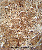 Serum Amyloid P Antibody in Immunohistochemistry (Paraffin) (IHC (P))