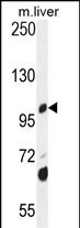 DHTKD1 Antibody in Western Blot (WB)