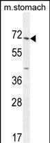 ESCO2 Antibody in Western Blot (WB)