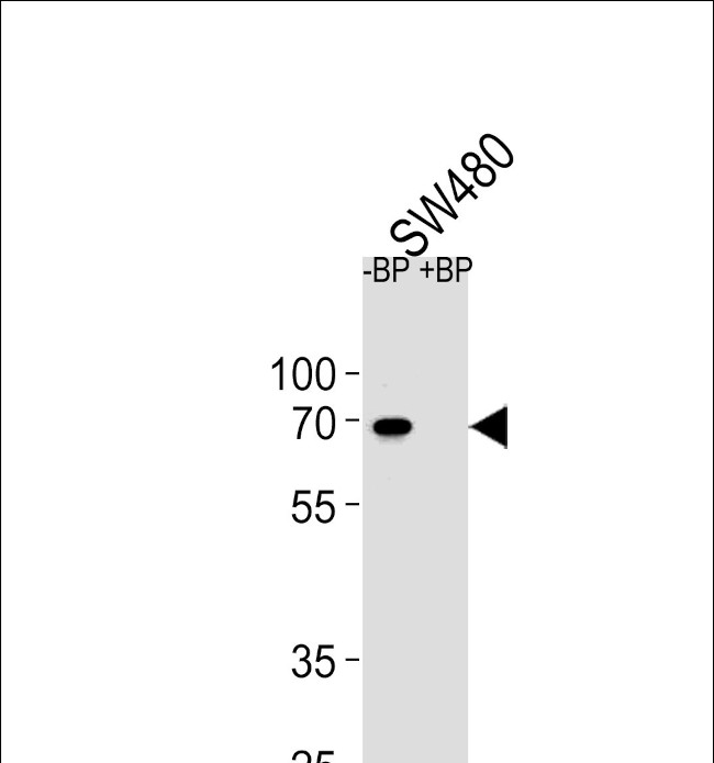 ETV5 Antibody in Western Blot (WB)