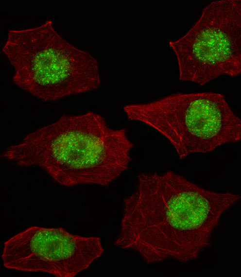 LMO4 Antibody in Immunocytochemistry (ICC/IF)