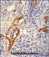 CLPX Antibody in Immunohistochemistry (Paraffin) (IHC (P))