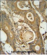 GCNT3 Antibody in Immunohistochemistry (Paraffin) (IHC (P))