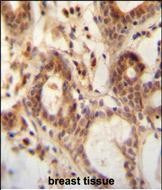 NUDT15 Antibody in Immunohistochemistry (Paraffin) (IHC (P))