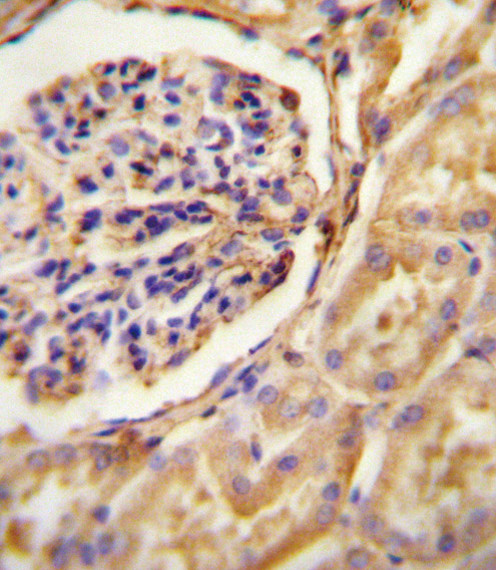 GNAT2 Antibody in Immunohistochemistry (Paraffin) (IHC (P))